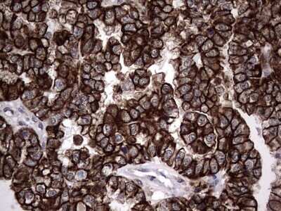 Immunohistochemistry: CCL19/MIP-3 beta Antibody (OTI2A12) [NBP2-46082]