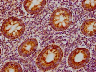 Immunohistochemistry: CCL19/MIP-3 beta Antibody (3A12) [NBP3-15143]