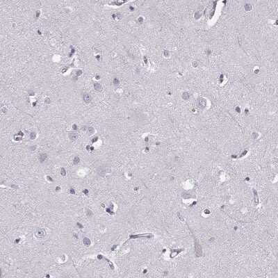 Immunohistochemistry-Paraffin: CCL19/MIP-3 beta Antibody [NBP2-56275]