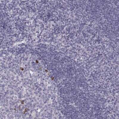 Immunohistochemistry-Paraffin: CCL19/MIP-3 beta Antibody [NBP2-56275]