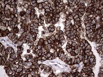 Immunohistochemistry: CCL19/MIP-3 beta Antibody (OTI2A12) - Azide and BSA Free [NBP2-71278]