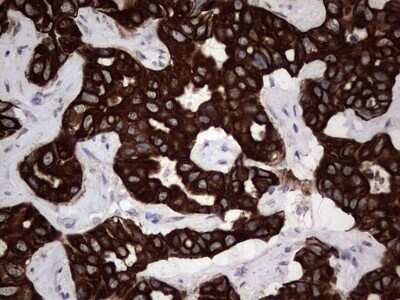 Immunohistochemistry: CCL19/MIP-3 beta Antibody (OTI2A12) - Azide and BSA Free [NBP2-71278]