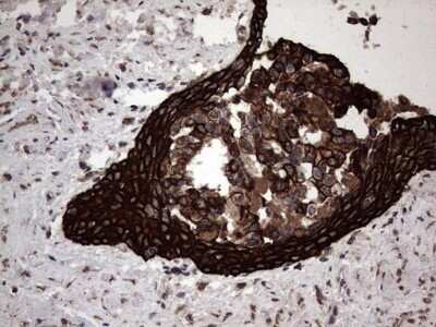 Immunohistochemistry: CCL19/MIP-3 beta Antibody (OTI2A12) - Azide and BSA Free [NBP2-71278]