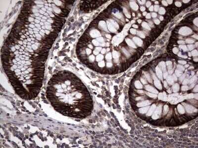 Immunohistochemistry: CCL19/MIP-3 beta Antibody (OTI2A12) - Azide and BSA Free [NBP2-71278]