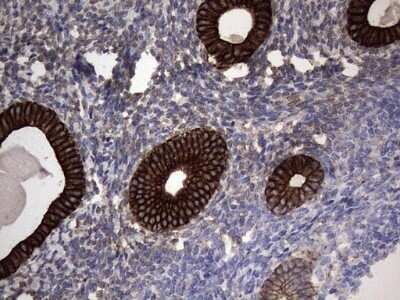 Immunohistochemistry: CCL19/MIP-3 beta Antibody (OTI2A12) - Azide and BSA Free [NBP2-71278]