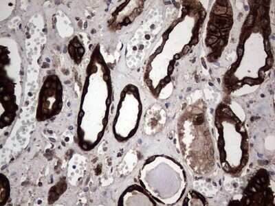 Immunohistochemistry: CCL19/MIP-3 beta Antibody (OTI2A12) - Azide and BSA Free [NBP2-71278]