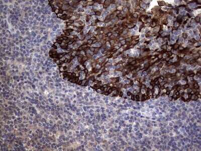 Immunohistochemistry: CCL19/MIP-3 beta Antibody (OTI2A12) - Azide and BSA Free [NBP2-71278]