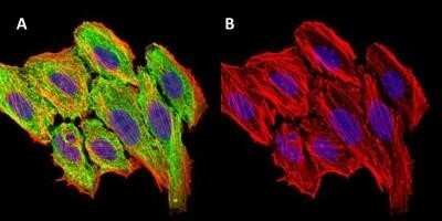 Immunocytochemistry/ Immunofluorescence: CCL2/MCP1 Antibody (2D8) - Azide and BSA Free [NBP2-80618]