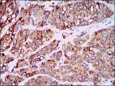 Immunohistochemistry-Paraffin: CCL2/MCP1 Antibody (2D8) - Azide and BSA Free [NBP2-80618]