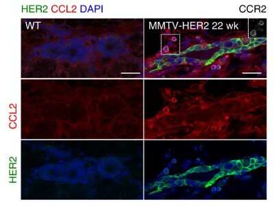 Immunohistochemistry: CCL2/MCP1 Antibody (2D8) - BSA Free [NBP2-22115]