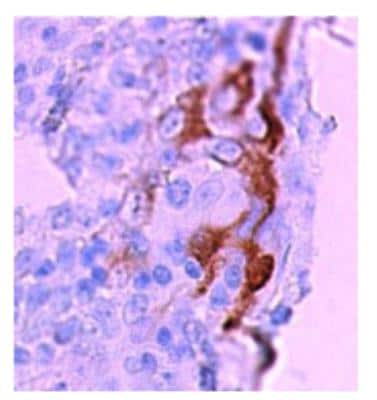 Immunohistochemistry: CCL20/MIP-3 alpha Antibody (308B7.06) [DDX0431P-100]