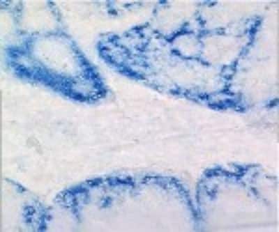 Immunohistochemistry: CCL20/MIP-3 alpha Antibody (319F6.06) [DDX0430P-100]