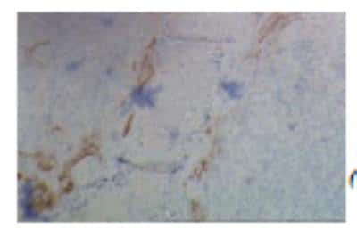 Immunohistochemistry: CCL20/MIP-3 alpha Antibody (319F6.06) [DDX0430P-100]