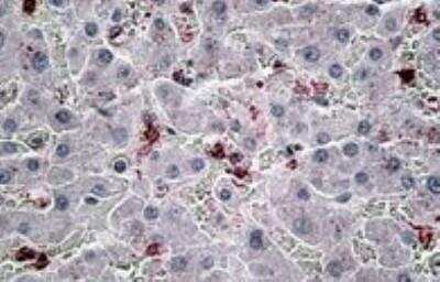 Immunohistochemistry-Paraffin: CCL20/MIP-3 alpha Antibody [NBP1-45246]