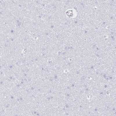 Immunohistochemistry-Paraffin: CCL21/6Ckine Antibody [NBP2-37928]
