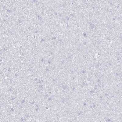 Immunohistochemistry-Paraffin: CCL21/6Ckine Antibody [NBP2-37928]
