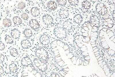 Immunohistochemistry-Paraffin: CCL25/TECK Antibody - Azide and BSA Free [NBP1-40993]