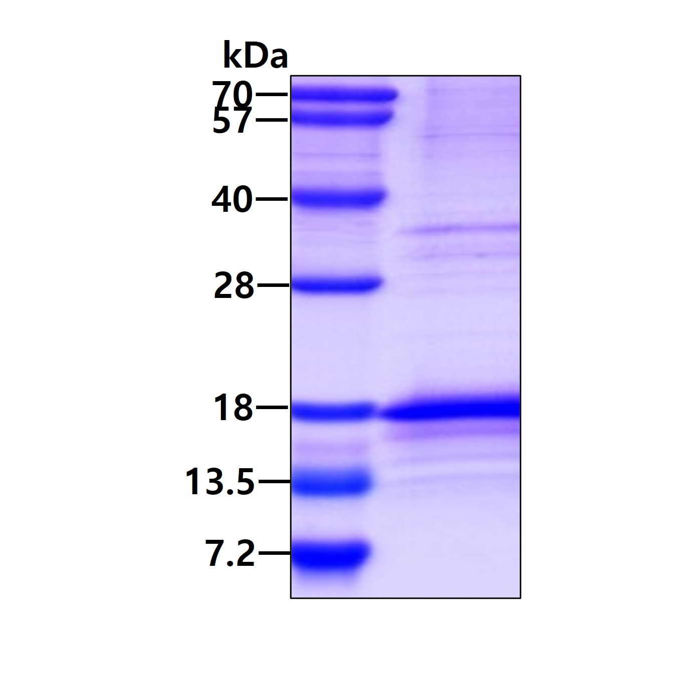 SDS-PAGE: Recombinant Human CCL25/TECK His Protein [NBP2-52003]