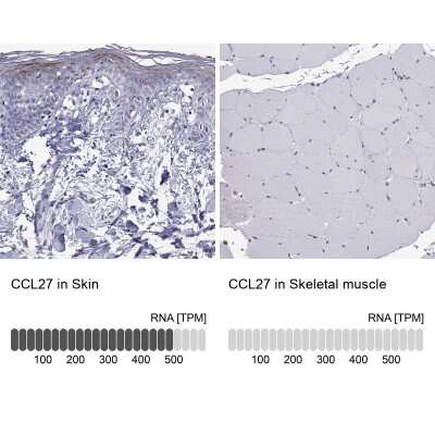 Immunohistochemistry-Paraffin: CCL27/CTACK Antibody [NBP2-62684]