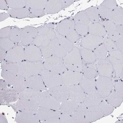 Immunohistochemistry-Paraffin: CCL27/CTACK Antibody [NBP2-62684]