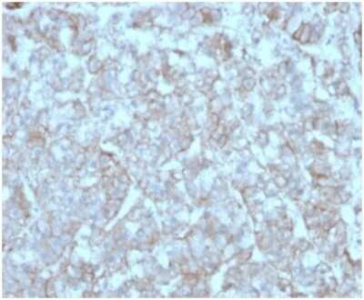 Immunohistochemistry-Paraffin: CCL8/MCP-2 Antibody (CCL8/3312) [NBP3-13769]