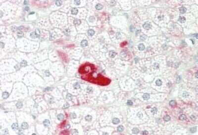 Immunohistochemistry-Paraffin: CCL8/MCP-2 Antibody [NBP1-79937]