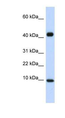 Western Blot: CCL8/MCP-2 Antibody [NBP1-79937]