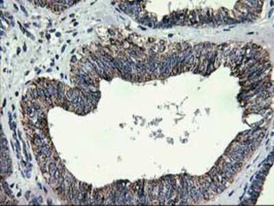 Immunohistochemistry-Paraffin: CCM2 Antibody (OTI1E9) [NBP2-01134]