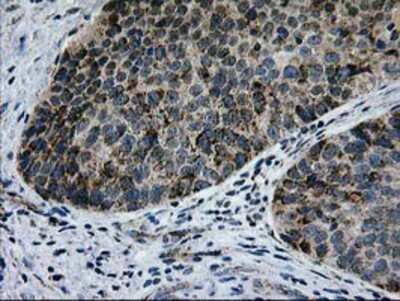Immunohistochemistry-Paraffin: CCM2 Antibody (OTI1E9) [NBP2-01134]