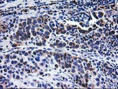 Immunohistochemistry-Paraffin: CCM2 Antibody (OTI1E9) [NBP2-01134]