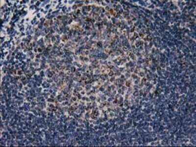 Immunohistochemistry: CCM2 Antibody (OTI1E9) - Azide and BSA Free [NBP2-72235]