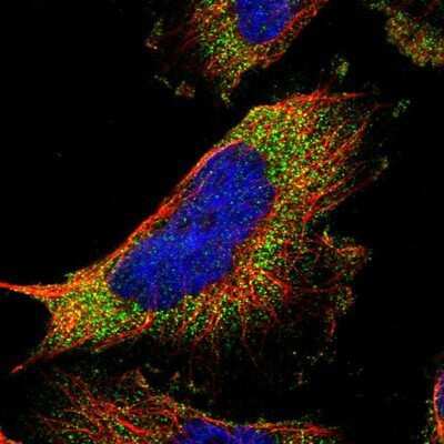 Immunocytochemistry/ Immunofluorescence: NOV/CCN3 Antibody [NBP1-88155]