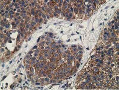 Immunohistochemistry-Paraffin: CCNB1IP1 Antibody (OTI4H3) [NBP2-00600]