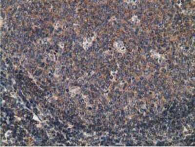 Immunohistochemistry-Paraffin: CCNB1IP1 Antibody (OTI4H3) [NBP2-00600]
