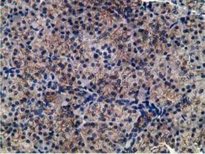 Immunohistochemistry-Paraffin: CCNB1IP1 Antibody (OTI4H3) [NBP2-00600]
