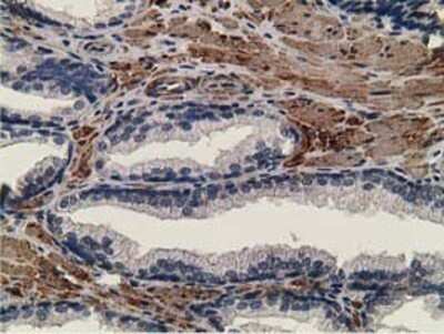 Immunohistochemistry: CCNB1IP1 Antibody (OTI4H3) - Azide and BSA Free [NBP2-72106]