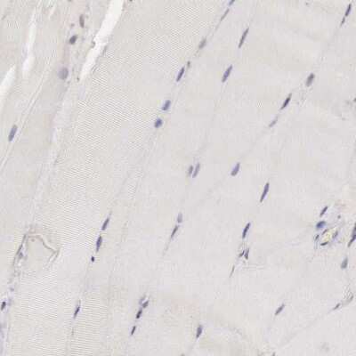 Immunohistochemistry-Paraffin: CCNB3 Antibody [NBP1-89475]