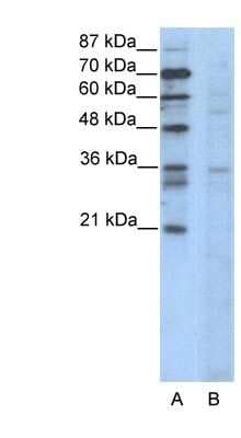 Western Blot: CCNB3 Antibody [NBP1-80127]
