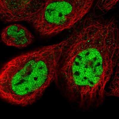 Immunocytochemistry/ Immunofluorescence: CCNDBP1 Antibody [NBP2-58940]
