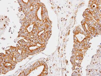 Immunohistochemistry-Paraffin: CCNDBP1 Antibody [NBP2-15762]