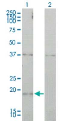 Western Blot: CCNL1 Antibody (1F7-1C5) [H00057018-M01]