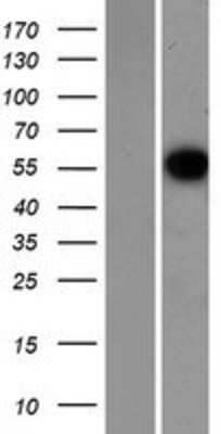 Western Blot: CCNL1 Overexpression Lysate [NBP2-06659]