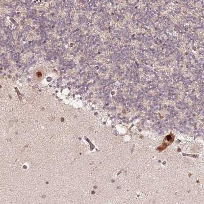 Immunohistochemistry-Paraffin: CCNYL1 Antibody [NBP1-91769]