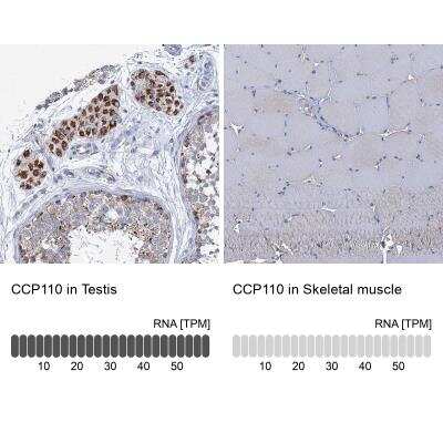 Immunohistochemistry-Paraffin: CCP110 Antibody [NBP2-13073]