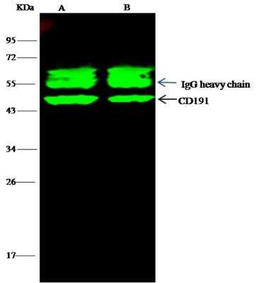 Immunoprecipitation: CCR1 Antibody (002) [NBP2-89234]