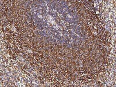 Immunohistochemistry-Paraffin: CCR1 Antibody (003) [NBP2-89235]
