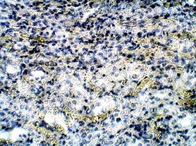 Immunohistochemistry-Paraffin: CCR1 Antibody [NBP1-78173]