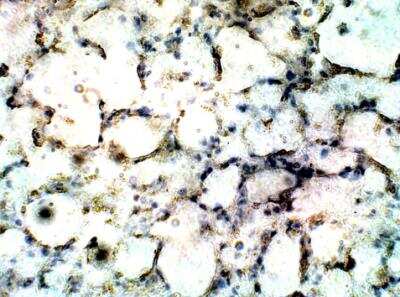 Immunohistochemistry-Paraffin: CCR1 Antibody [NBP1-78173]