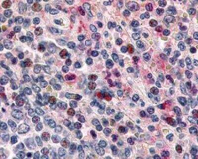 Immunohistochemistry-Paraffin: CCR1 Antibody - BSA Free [NLS1242]