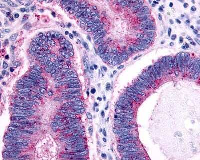 Immunohistochemistry-Paraffin: CCR1 Antibody - BSA Free [NLS1242]
